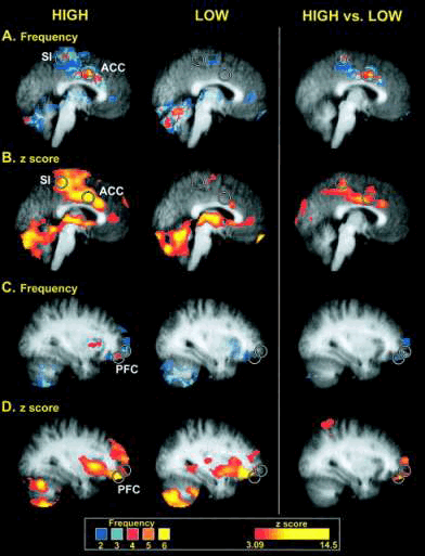 high and low sensitivity brain imaging