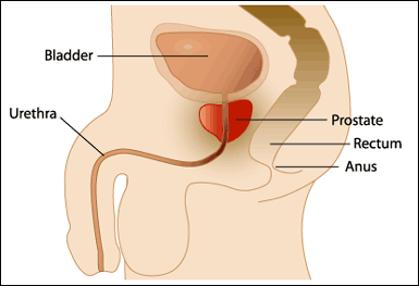 Prostate Cancer