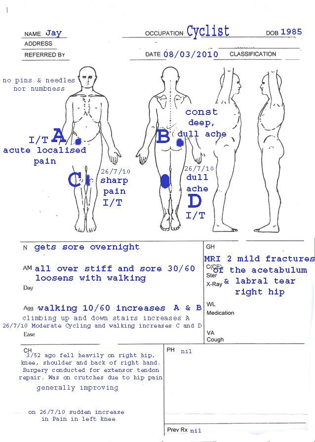 Body Chart Physio