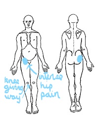 body chart femoral artery haematoma