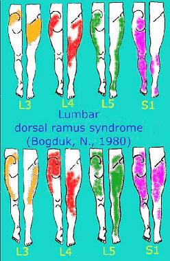 injury blog: thoracic outlet syndrome