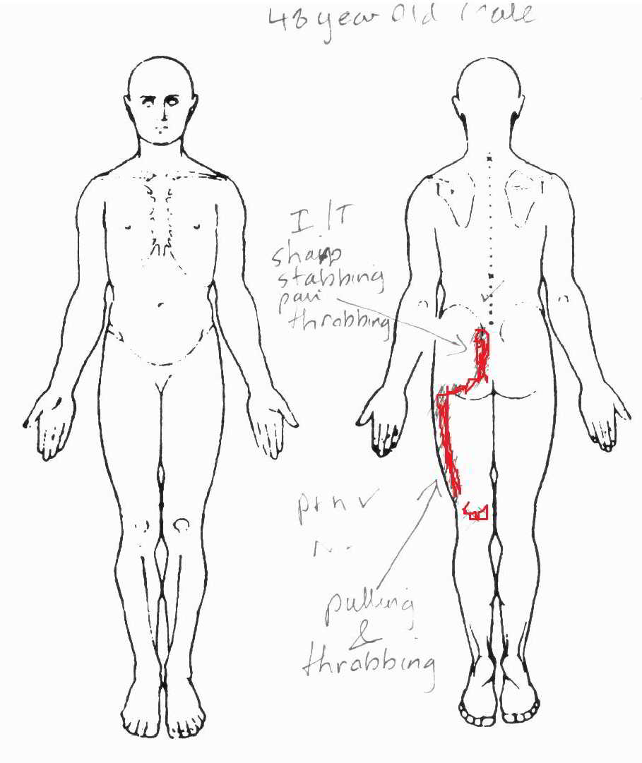 Body Chart SIJ pain