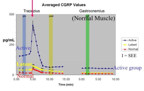 Myofascial Trigger Point Neurochemicals CGRP 5