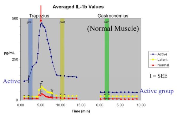 Myofascial Trigger Point Neurochemicals IL 1b 7