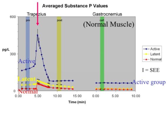 Myofascial Trigger Point Neurochemicals Sub P 4