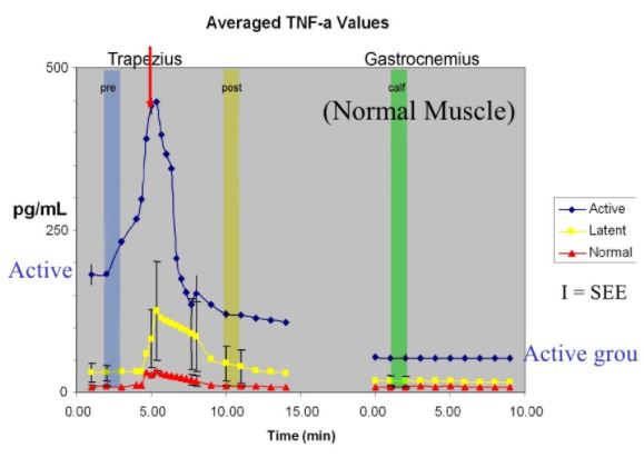 Myofascial Trigger Point Neurochemicals TNF alpha 6