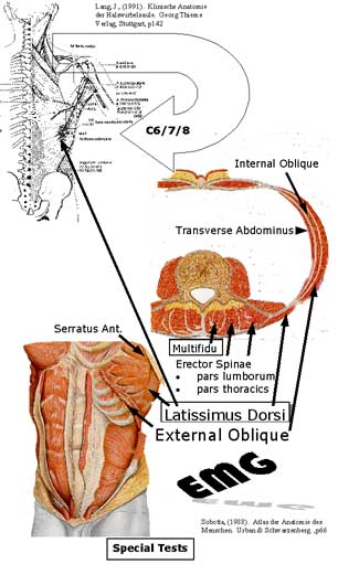 Breaking Down Multifidus Muscle Pain: Causes and Symptoms