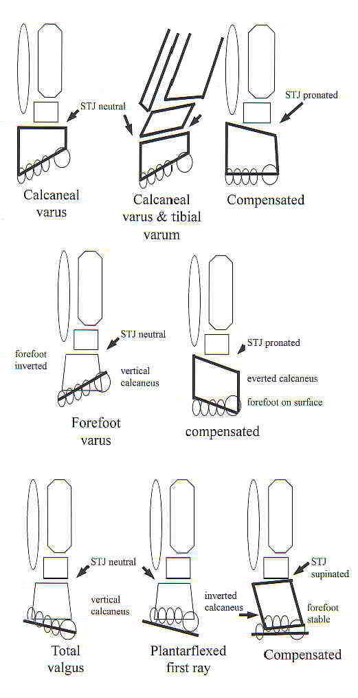 Dorsiflexion, Plantar Flexion, Eversion & Inversion - Trial Exhib