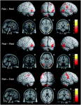 Pain in the Brain - neural plasticity