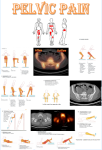 Sacroiliac Pain - imaging and stability testing exercises
